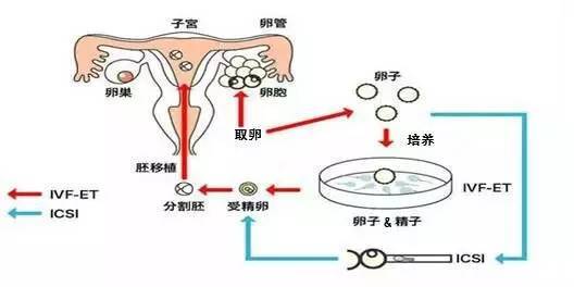 大连捐卵医院